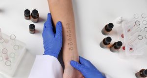 Alergije test