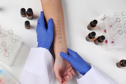 Alergije test